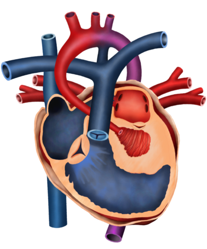 Zespół hipoplazji serca lewego