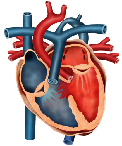 Przerwanie ciągłości łuku aorty